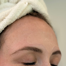 Pimple Patch Full Face – 15 Hydrocolloid Patches for Chin, Cheeks, Nose and Forehead