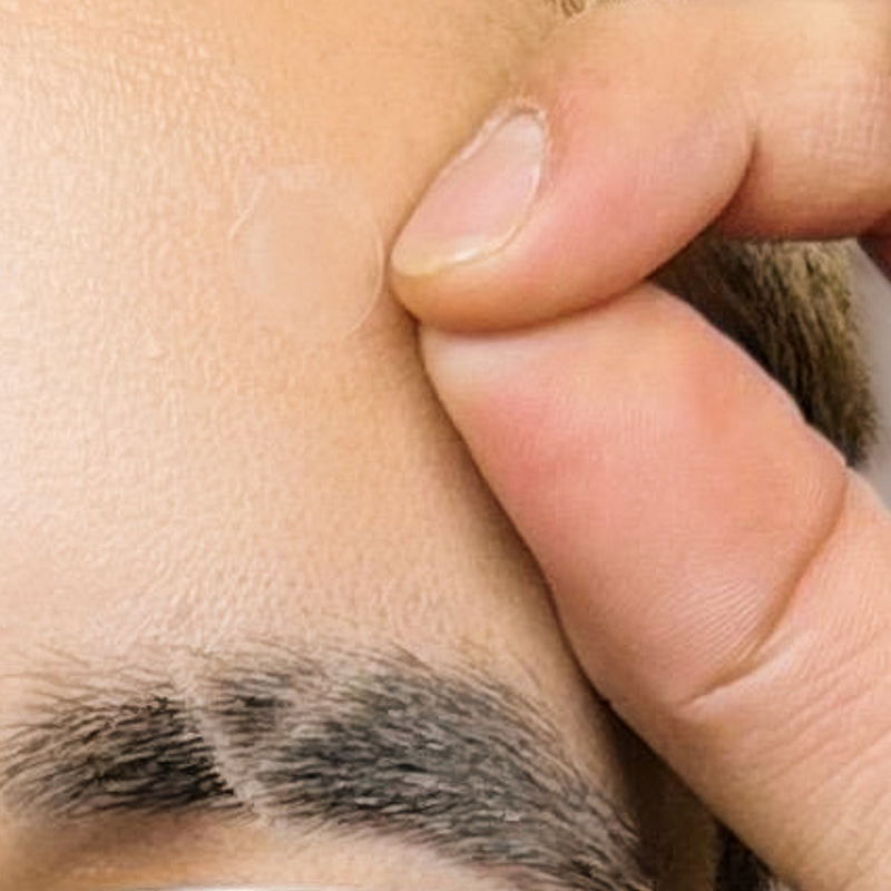 Pimple Patch Ultra – 48 Invisible Hydrocolloid Patches with Tapered Edges